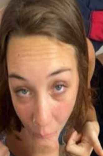 Rebecka, 32 år